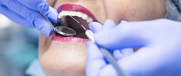 Best Emergency Wisdom Tooth Extraction in Wickes, AR